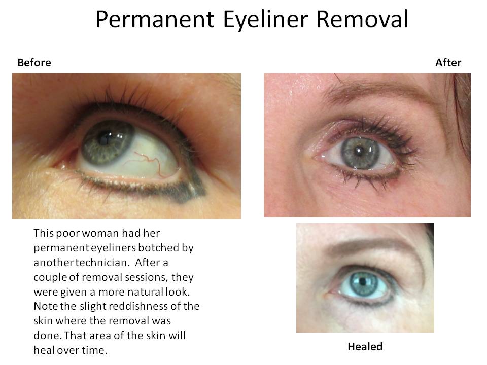 how to remove permanent makeup at home - Style Guru ...