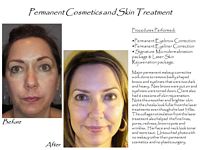 permanent makeup and anti-aging and laser skincare